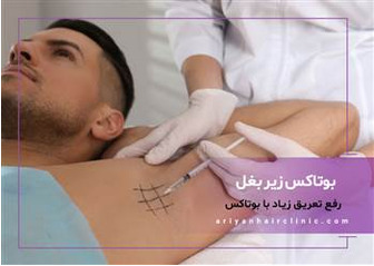 بوتاکس درمانی برای تعریق بیش ازحد